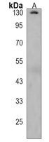 TRAP150 Rabbit Polyclonal Antibody