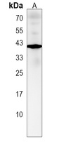 ZNF843 Rabbit Polyclonal Antibody