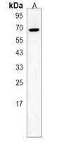 ZNF90 Rabbit Polyclonal Antibody