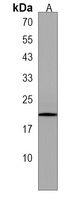 DNAJC24 Antibody