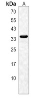 OR2T11 Rabbit Polyclonal Antibody