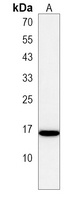 C22orf26 Rabbit Polyclonal Antibody