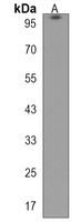 TAX1BP1 Rabbit Polyclonal Antibody