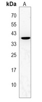 P2Y6 Rabbit Polyclonal Antibody