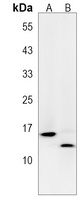 FAU Rabbit Polyclonal Antibody