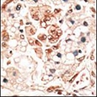 Anti-HPCA Antibody