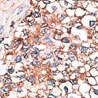 Anti-GJA9 Antibody