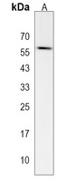 SLC45A3 Rabbit Polyclonal Antibody