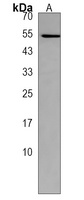 ALDH8A1 Rabbit Polyclonal Antibody