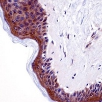 RAP55A Antibody