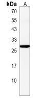 TEX40 Rabbit Polyclonal Antibody