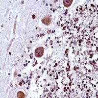 Anti-TRA2B Antibody
