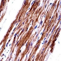 Anti-MYL9 Antibody
