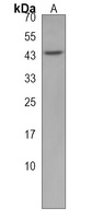 TGIF1 Rabbit Polyclonal Antibody