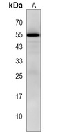 FOXD1 Rabbit Polyclonal Antibody