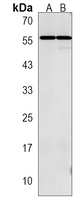 GTF2A1L Rabbit Polyclonal Antibody