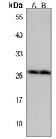 FRAT1 Antibody