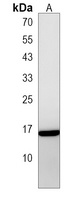 TM4SF18 Antibody