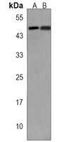 EVX2 Rabbit Polyclonal Antibody