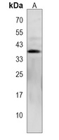 NAPB Rabbit Polyclonal Antibody