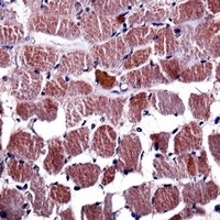 Anti-RGS9 Antibody