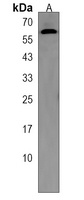 KIAA0895 Rabbit Polyclonal Antibody