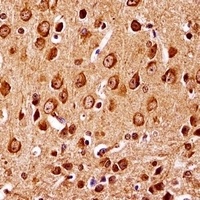 Anti-MKK7 Antibody