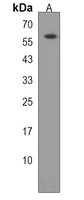 PDIA5 Antibody