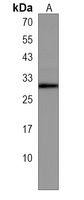 CIDEA Rabbit Polyclonal Antibody