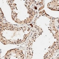 PDCD4 Antibody