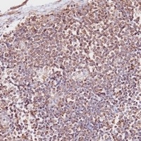 Anti-CD163b Antibody
