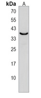 PNPLA4 Rabbit Polyclonal Antibody