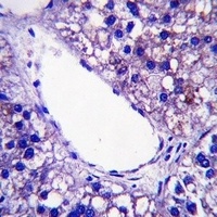 Anti-PNPLA4 Antibody