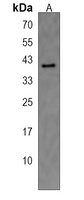 WNT8B Rabbit Polyclonal Antibody