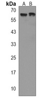 EHD1 Rabbit Polyclonal Antibody