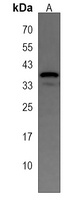 SYT2 Rabbit Polyclonal Antibody