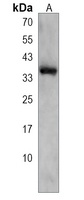 CELA3B Rabbit Polyclonal Antibody