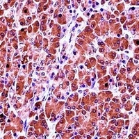 CELA3B Rabbit Polyclonal Antibody