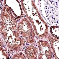 RANBP3L Antibody