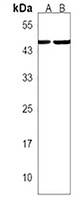 CCR10 Rabbit Polyclonal Antibody