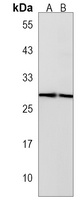 Histone H1X Rabbit Polyclonal Antibody