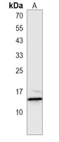 HIST2H2AA3 Rabbit Polyclonal Antibody