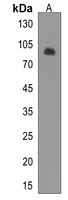 PPP1R3F Antibody