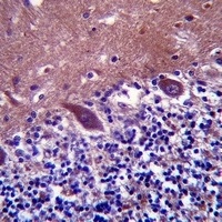 Anti-TTC13 Antibody