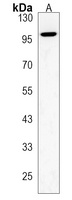 ZCCHC14 Rabbit Polyclonal Antibody