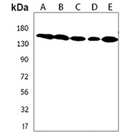 XIRP1 Rabbit Polyclonal Antibody