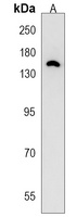 TIAM2 Rabbit Polyclonal Antibody
