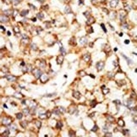 Anti-APOBEC1 Antibody