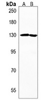 ZBTB11 Rabbit Polyclonal Antibody