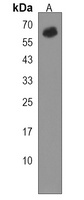 UGT2B11 Rabbit Polyclonal Antibody